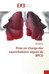 Prise en charge des exacerbations aiguës de BPCO