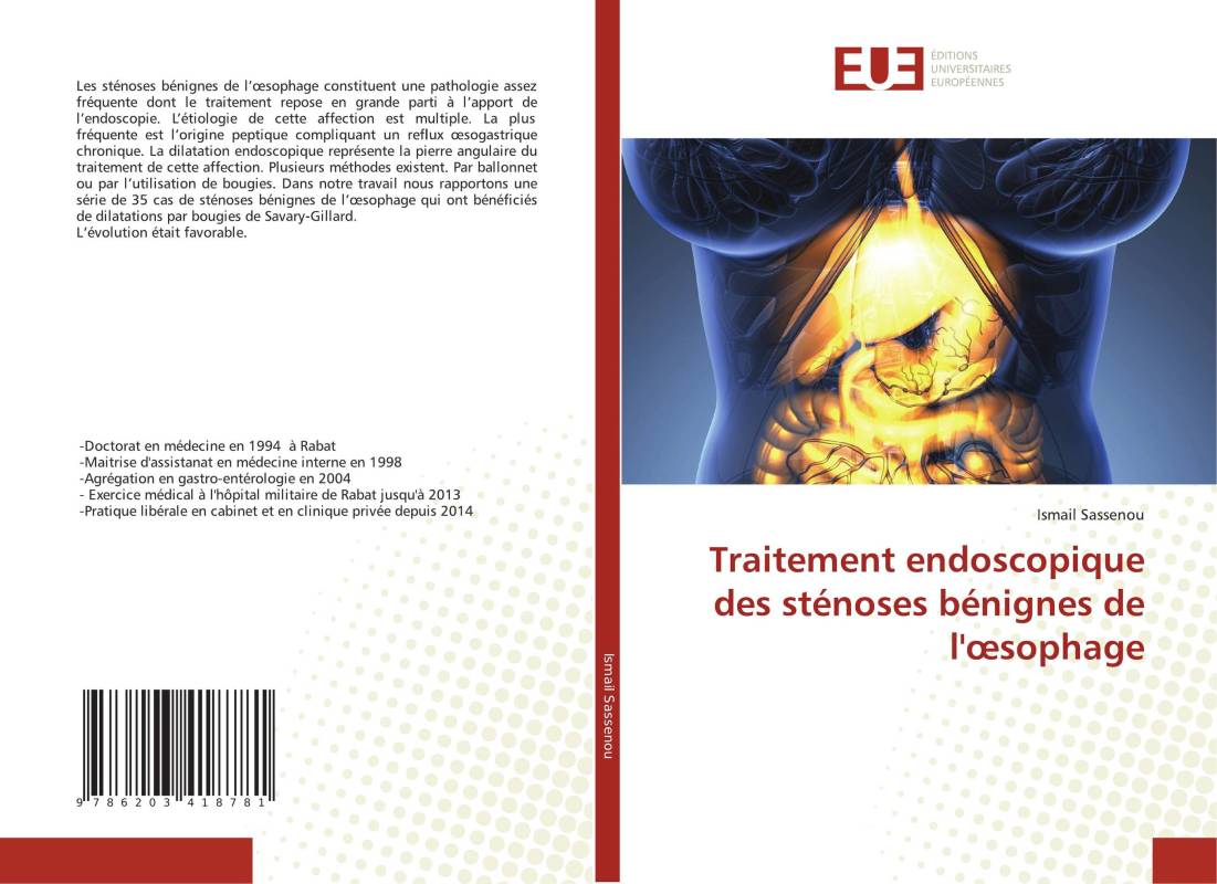 Traitement endoscopique des sténoses bénignes de l'œsophage