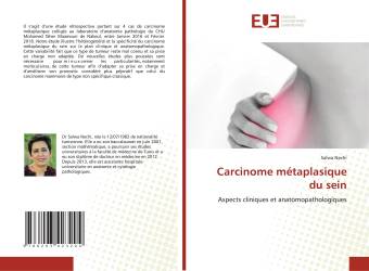 Carcinome métaplasique du sein