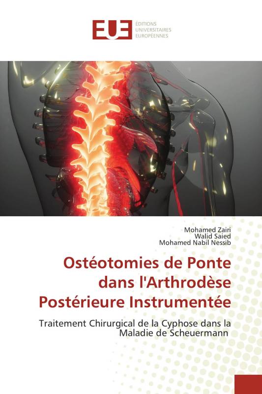 Ostéotomies de Ponte dans l'Arthrodèse Postérieure Instrumentée