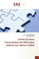 L'Anse de Seau Traumatique du Ménisque Interne sur Genou Stable