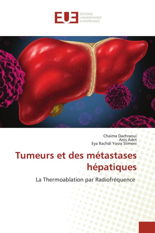 Tumeurs et des métastases hépatiques