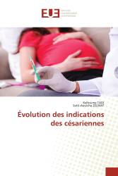 Évolution des indications des césariennes