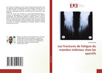 Les fractures de fatigue du membre inférieur chez les sportifs