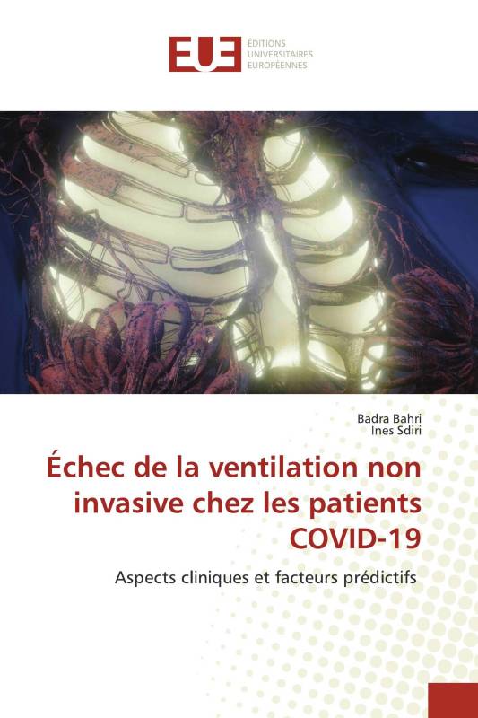 Échec de la ventilation non invasive chez les patients COVID-19