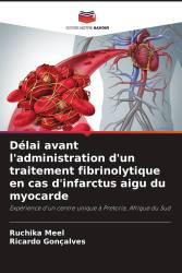 Délai avant l'administration d'un traitement fibrinolytique en cas d'infarctus aigu du myocarde