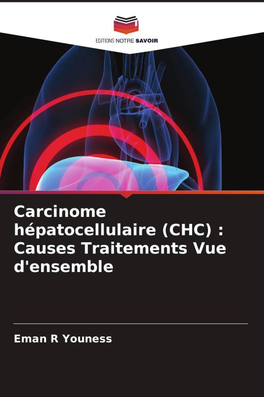 Carcinome hépatocellulaire (CHC) : Causes Traitements Vue d'ensemble