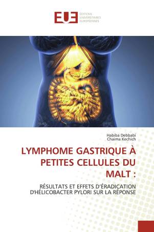 LYMPHOME GASTRIQUE À PETITES CELLULES DU MALT :