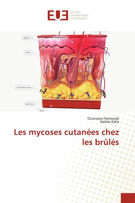 Les mycoses cutanées chez les brûlés