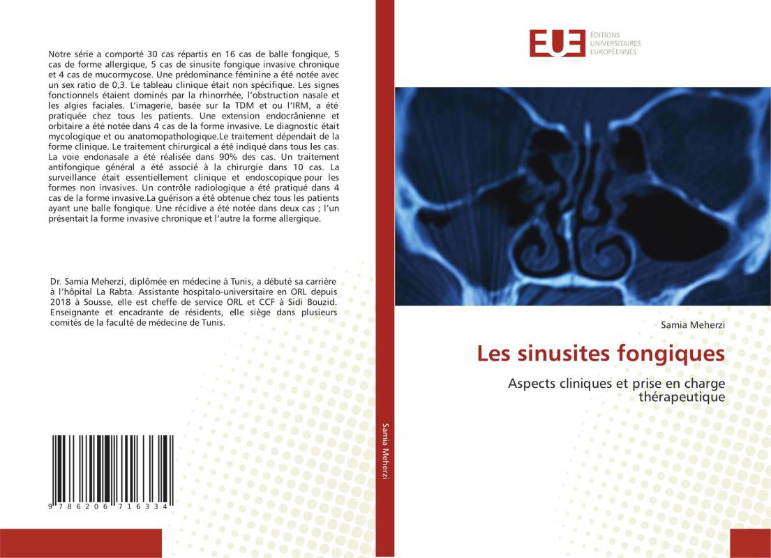 Les sinusites fongiques