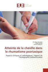 Atteinte de la cheville dans le rhumatisme psoriasique